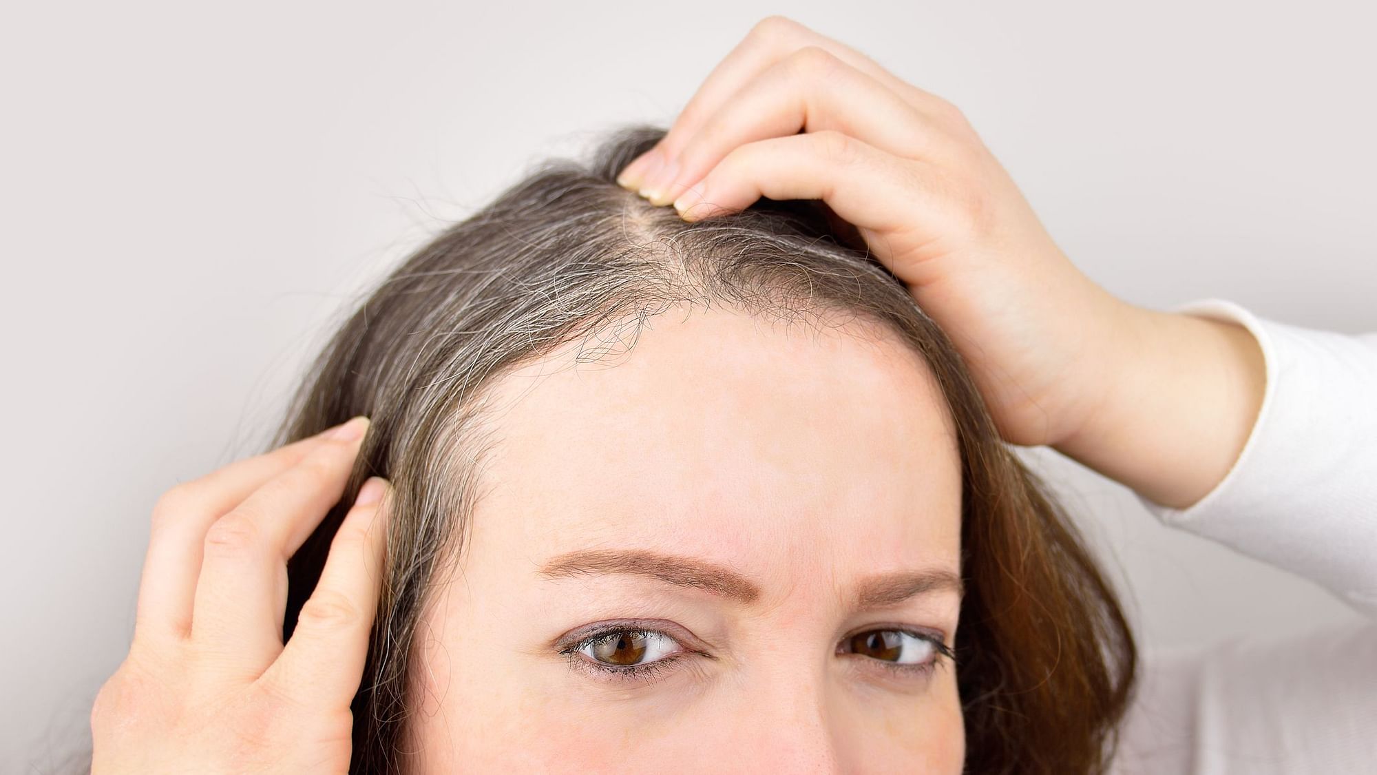 Struggling with Premature Greying? Ayurveda May Be Able to Help