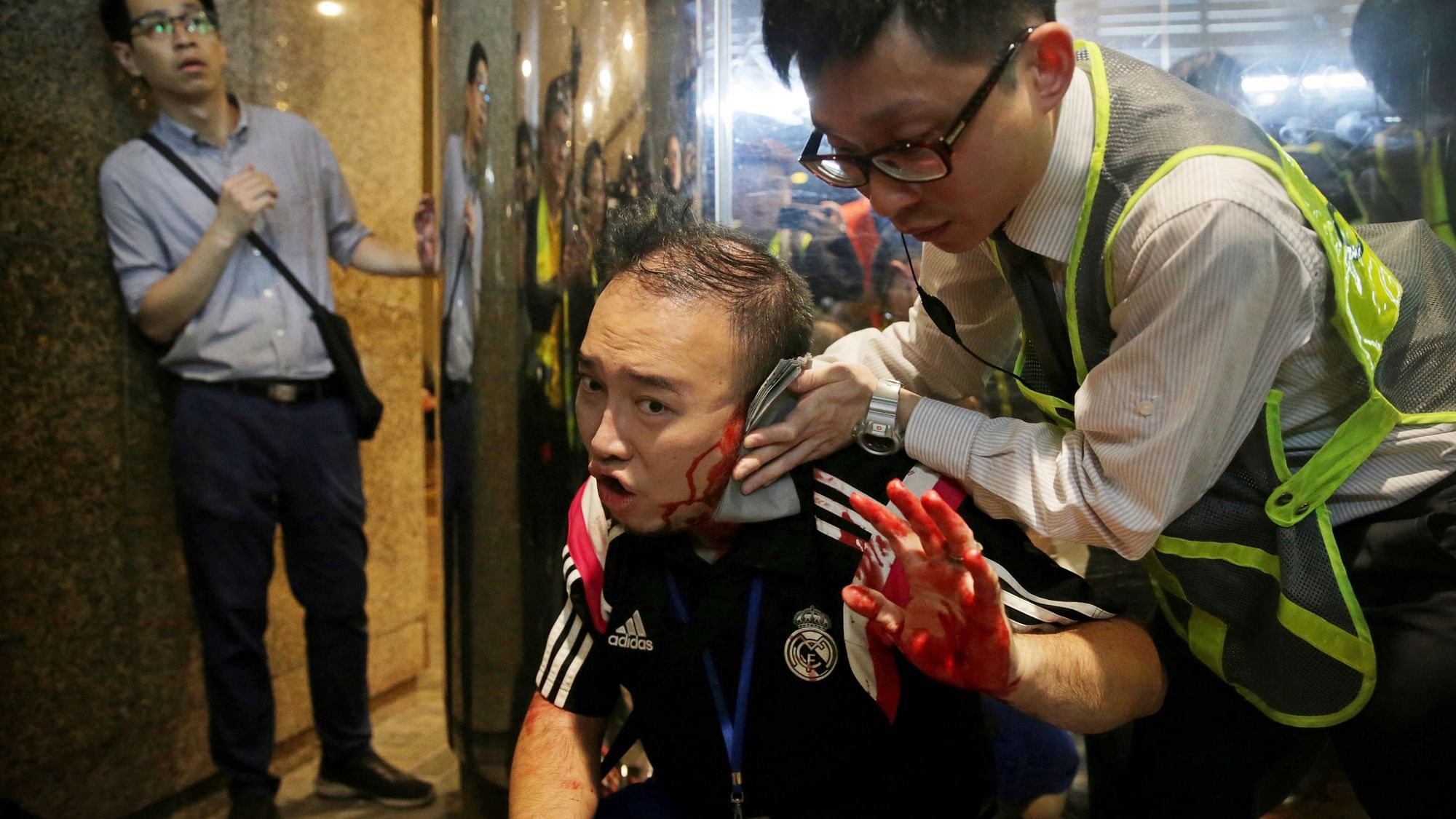  District councilor Andrew Chiu receives medical treatment in Hong Kong on 3 November.&nbsp;