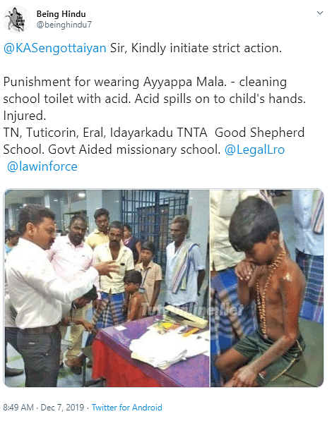 The boy was asked to clean chemistry lab in his school when an acid bottle fell on him, which caused injuries.