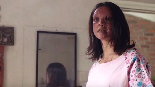 Deepika Padukone plays an acid attack survivor in ‘Chhapaak’.