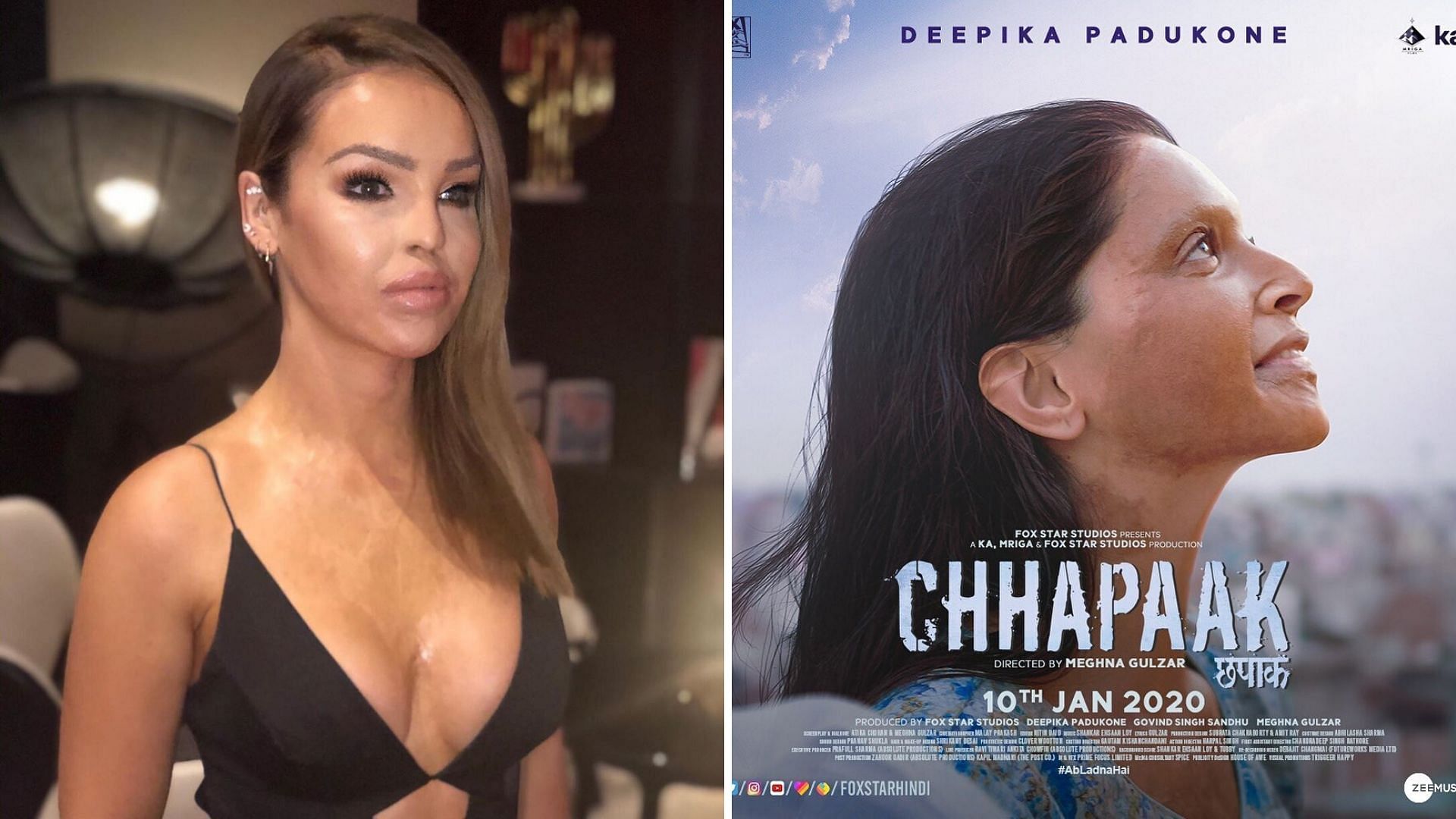 Katie Piper (L) and poster of <i>Chhapaak </i>(R)