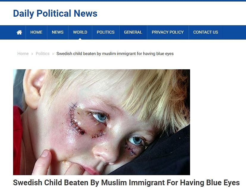 Image of a dog attack victim is being shared as a Swedish child attacked by Muslim immigrants for having blue eyes.