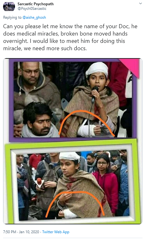 Did JNUSU Prez Aishe Ghosh Fake Injury? No, It’s a Mirror Image