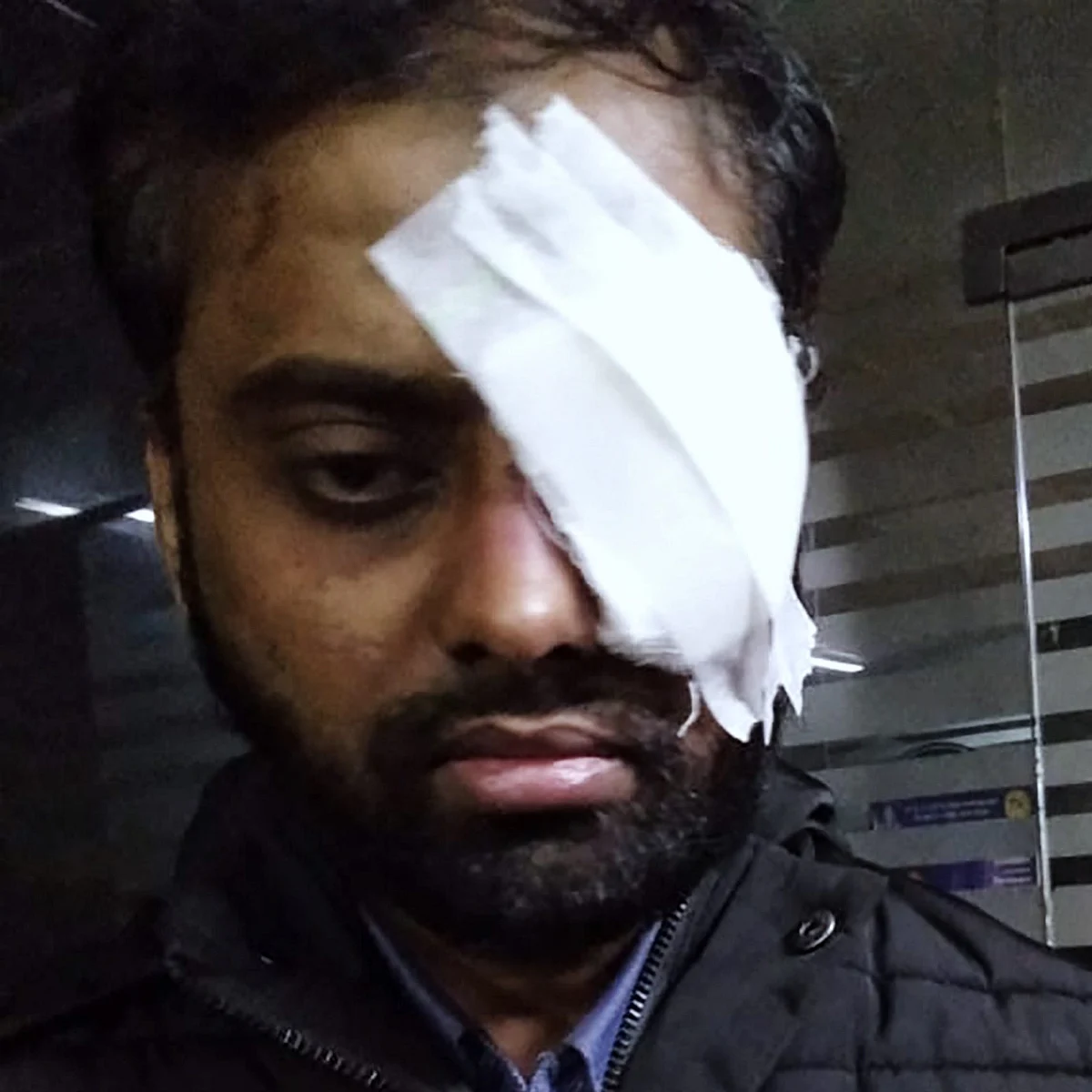 Mohd Minhajuddin, LLM student in Jamia, lost his left eye. 