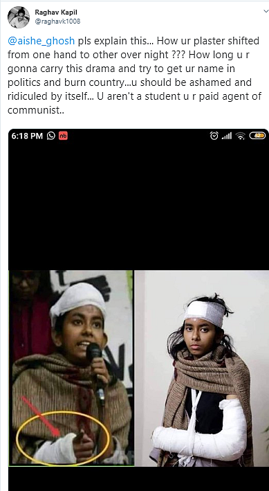 Did JNUSU Prez Aishe Ghosh Fake Injury? No, It’s a Mirror Image