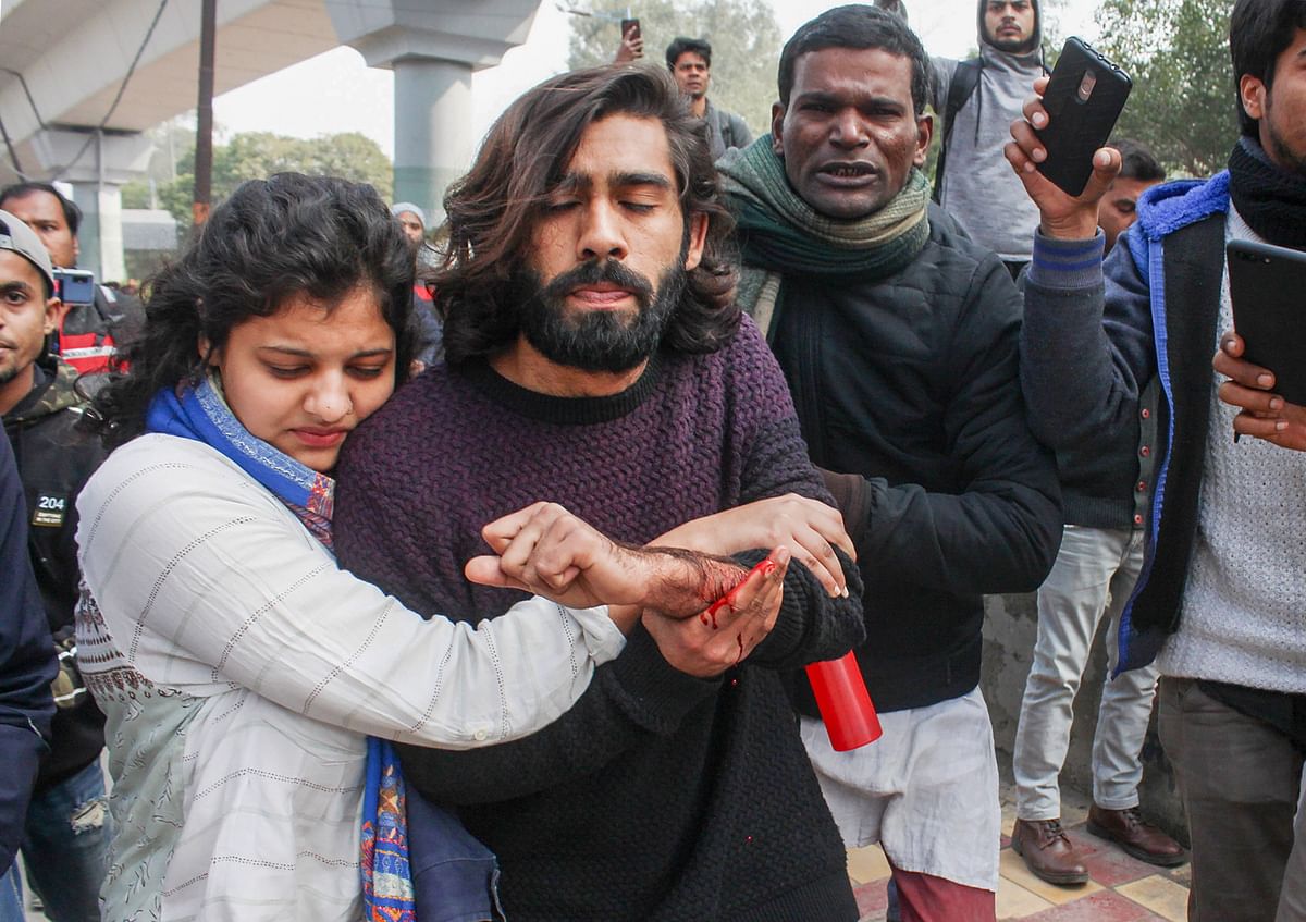 Soon after the incident, images of Shadab holding his bleeding hand and being comforted by a friend were shared. 