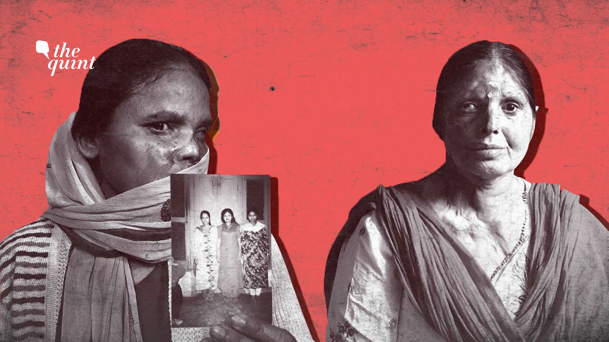 Acid attack survivors continue to battle bureaucratic and legal hurdles for due compensation by state government.