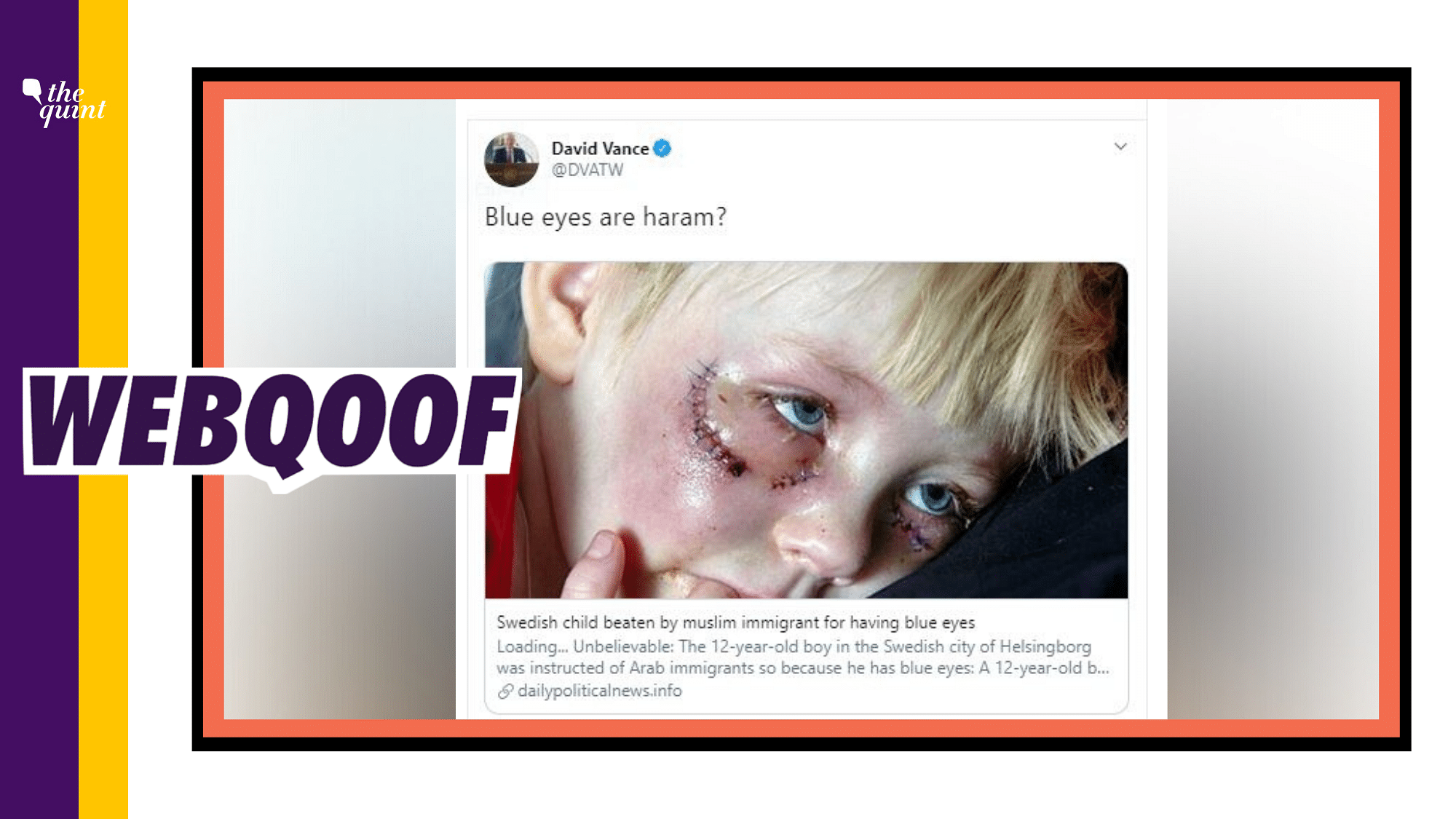 A graphic image of a dog attack victim is being shared as a Swedish child attacked by Muslim immigrants for having blue eyes.&nbsp;