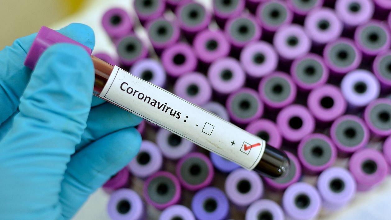 Patients of the coronavirus found with early lung infection