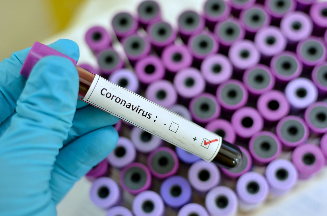 Two Japanese citizens evacuated from the epicentre of a novel coronavirus outbreak have been diagnosed with the infection after initially testing negative
