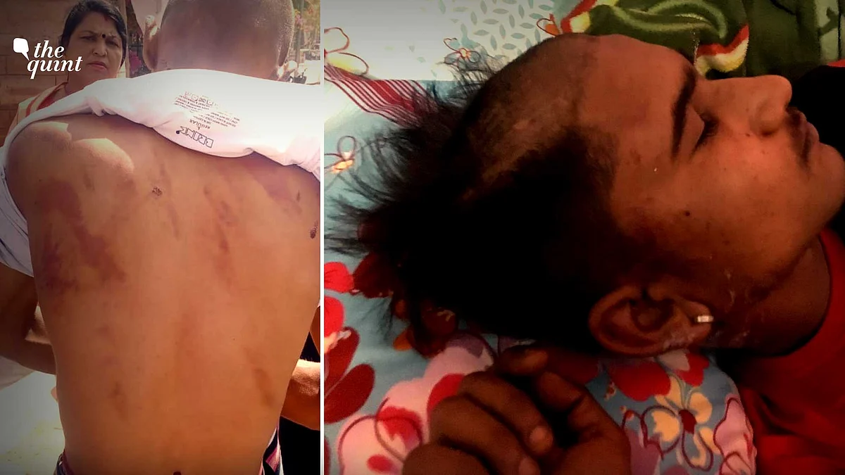 A Dalit boy was allegedly beaten up and his head was forcefully shaved in Jodhpur for meeting a girl from upper caste.