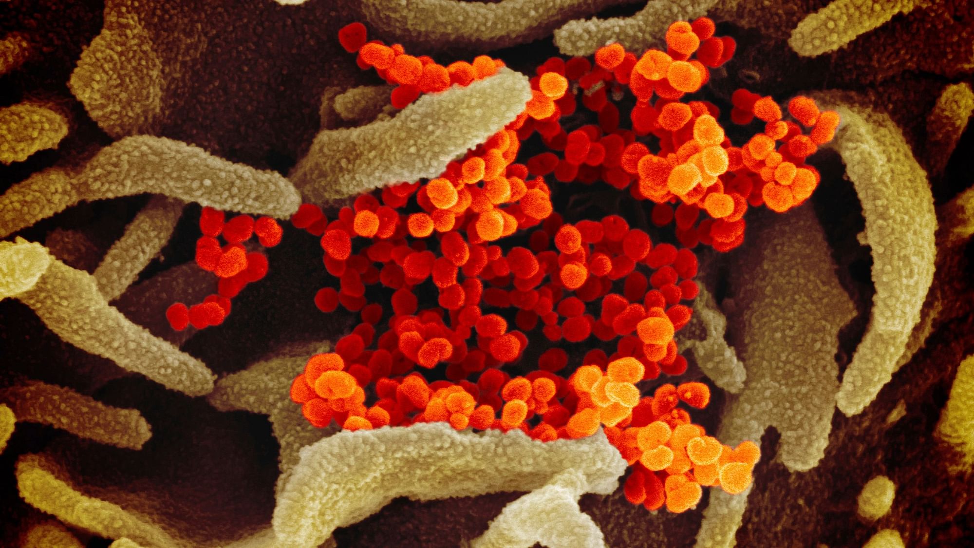 This undated electron microscope image made available by the US National Institutes of Health in February shows the Novel Coronavirus SARS-CoV-2. 