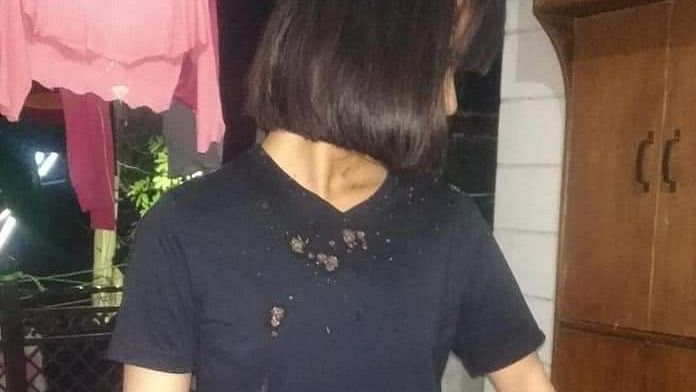 A woman from Manipur alleged that an unidentified man spat on her and called her "corona" in northwest Delhi's Vijay Nagar area.
