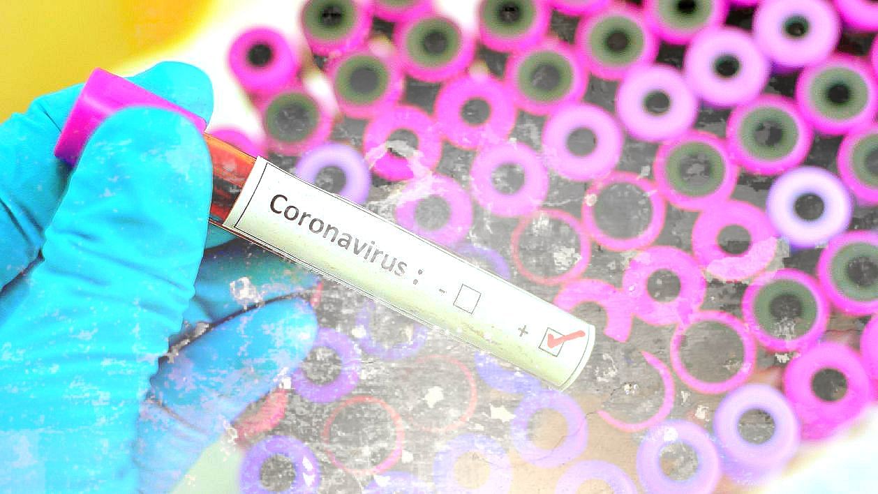 A 30-year-old migrant worker in Akola tested positive for coronavirus on 10 April and allegedly killed himself the following day.