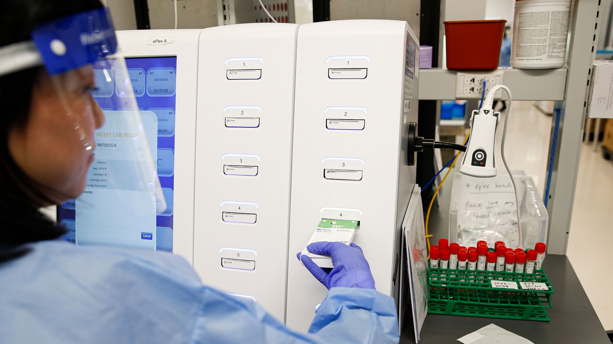 A laboratory technician prepares COVID-19 patient samples for semi-automatic testing. Representational image.