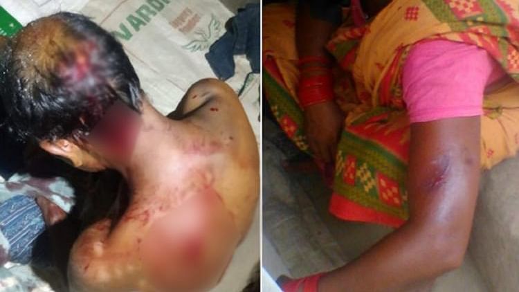 Horrific images of physical assault on labourers in a brick kiln from Tiruvallur district in Tamil Nadu.