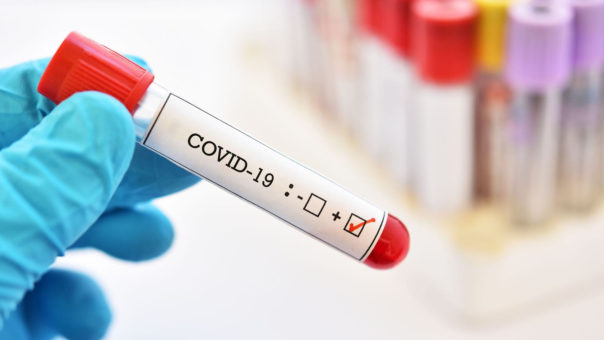 A guide on all that we know about antibody testing for COVID-19 in India.