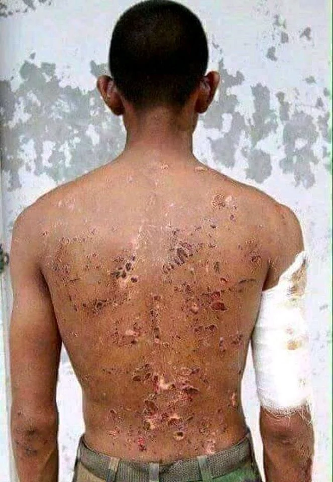 Photos From a 2016 Blog Shared as Indian Soldier Injured in Galwan