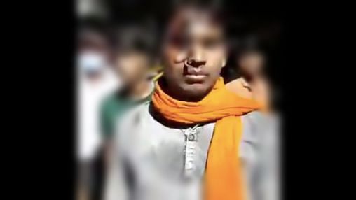 Three police personnel in Uttarakhand have reportedly been suspended for allegedly stabbing a key into the forehead of a man.