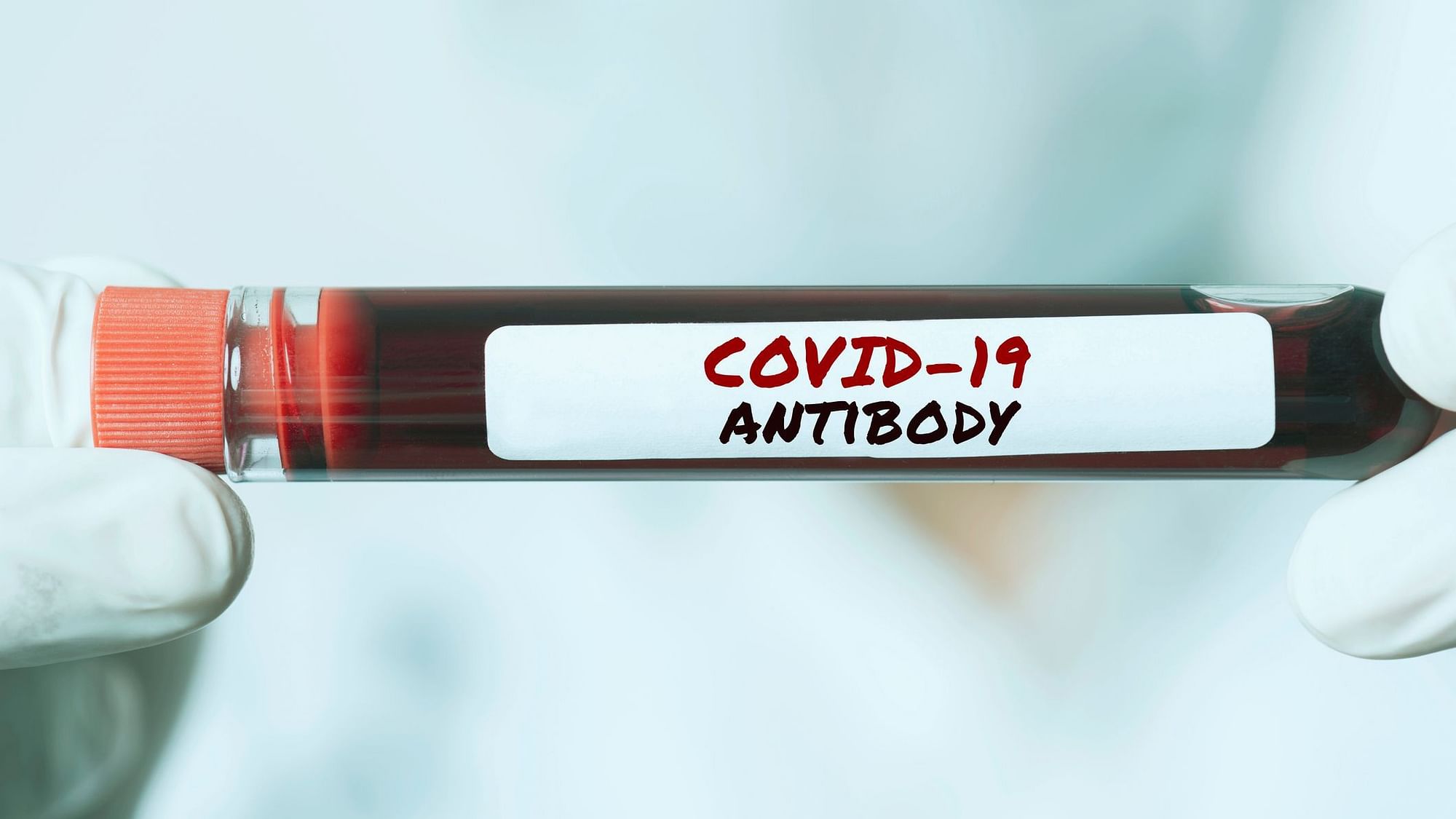 Latest Edition of ICMR-NIN sero survey has revealed that one out of four people in Telangana have COVID-19 antibodies.