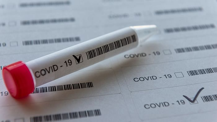 COVID-19 FAQ: What Are Saliva Tests and How Do They Work?