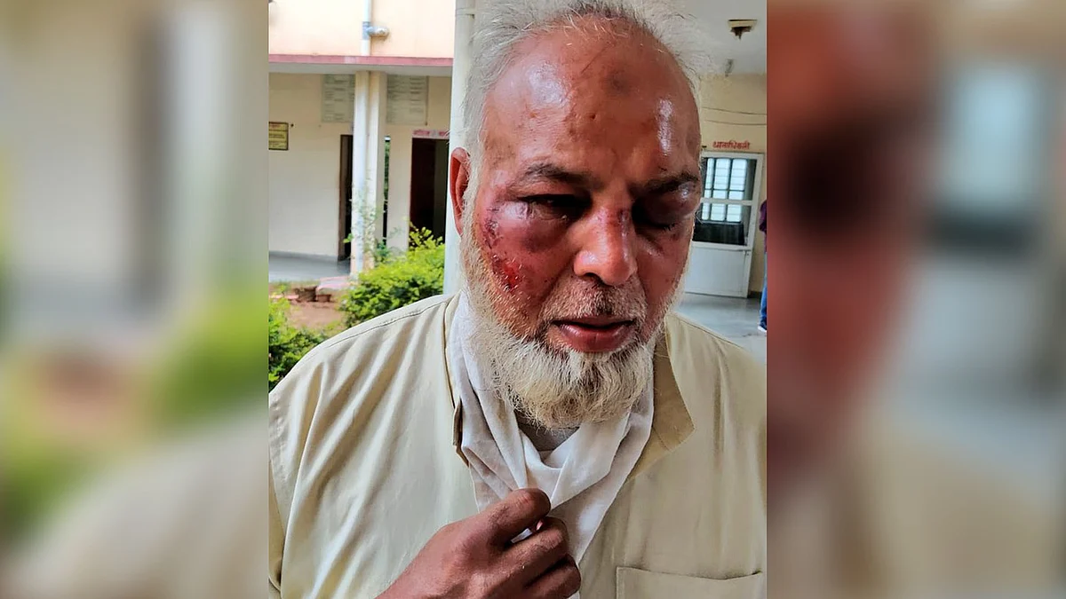 The man was also robbed of Rs 700 and his wrist watch.