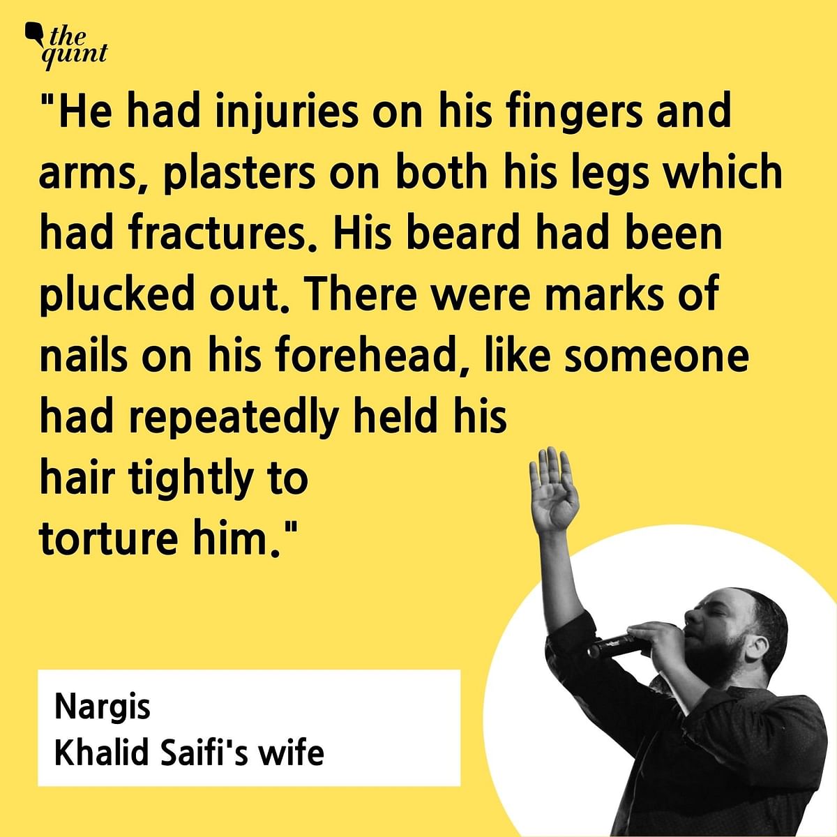 “Khalid’s beard had been plucked, he had nail marks on his forehead and plasters on both his legs,”his wife said.