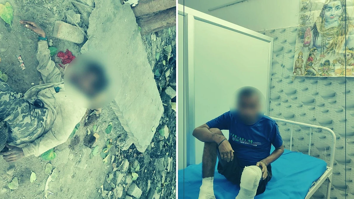 Various cases of homeless humans, severely injured, some with maggot-infested body parts were reported, amid the COVID-19 related lockdown.