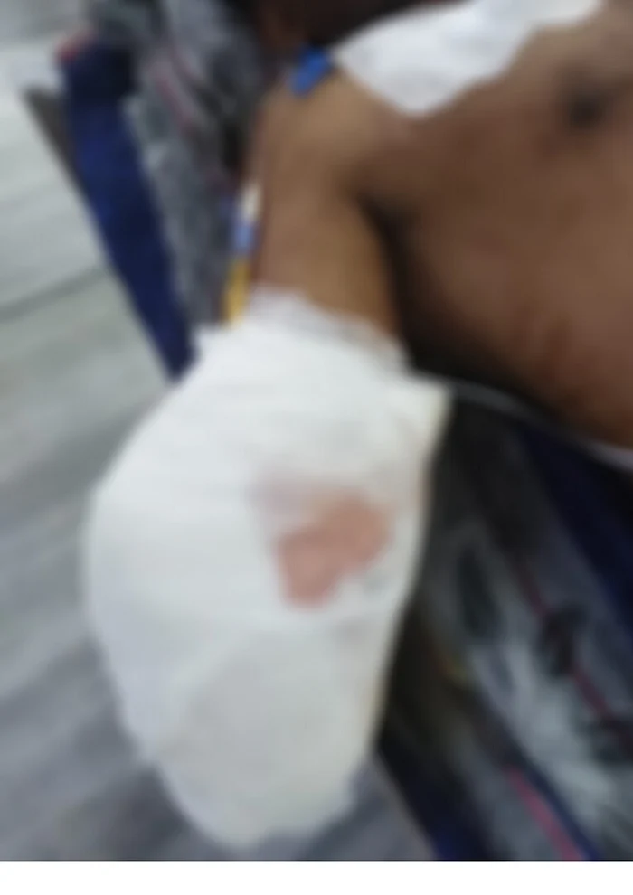 Akhlaq had said in his complaint, that while he sat in a park in Panipat, he was picked on by some locals who say the 786 tattoo on his arm and identified him as a Muslim. 786 is a number which is used as a metonym for the Arabic phrase Bismillah, meaning, in the name of Allah.