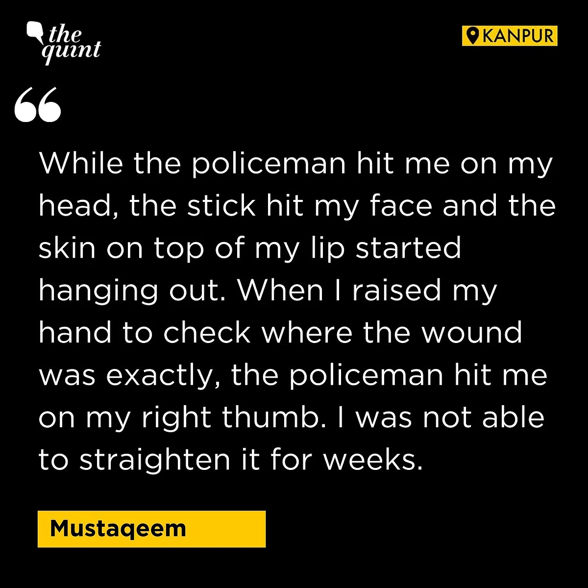 ‘Police Burnt My Beard’: Painful Details of Violence in UP Emerge