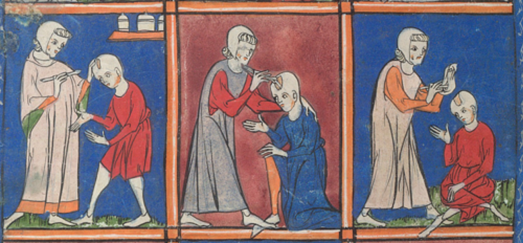 Some medieval medical treatments seemed less than relaxing
