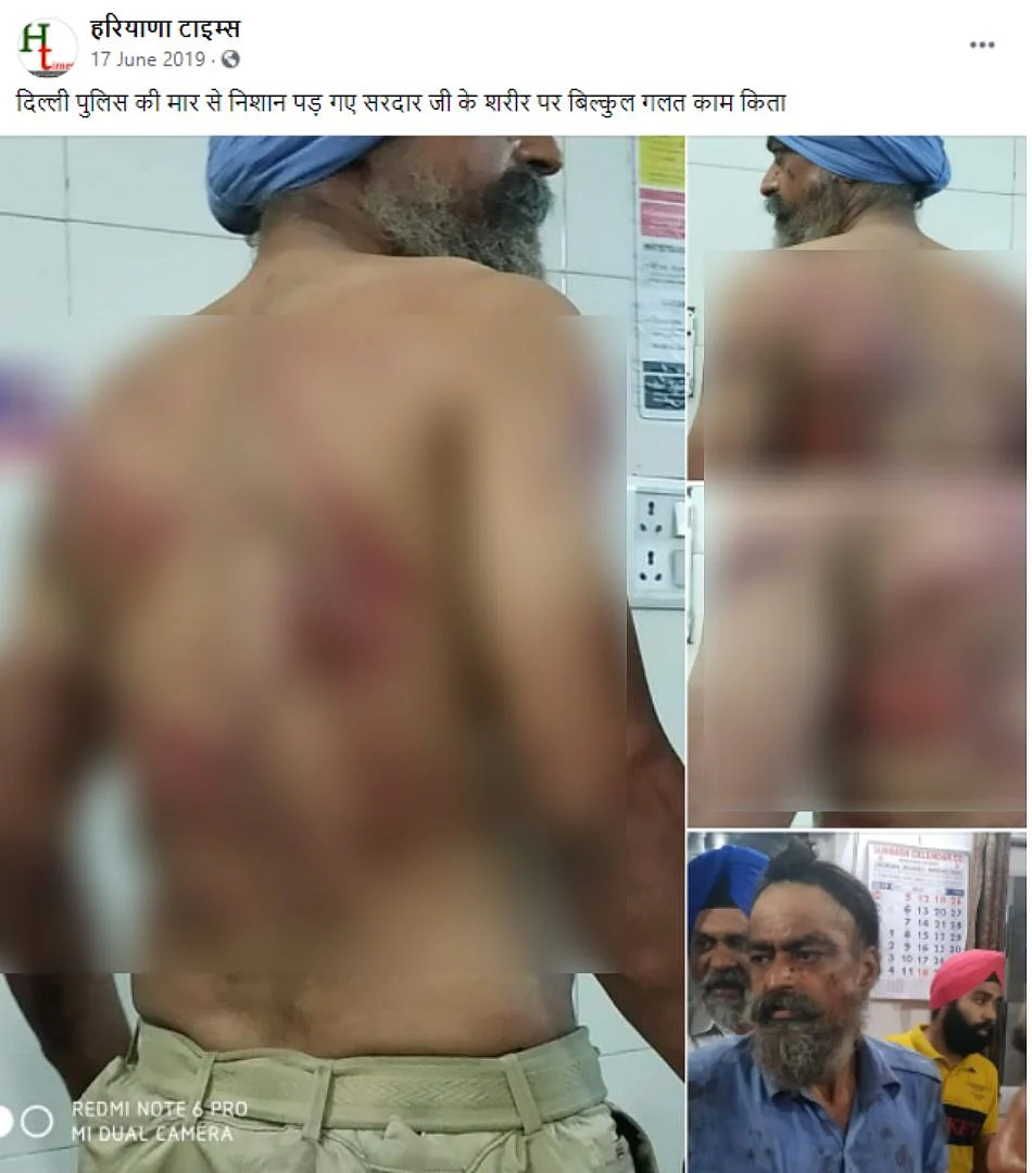 Old Image of Injured Sikh Man Revived after Farmers’ R-Day Rally