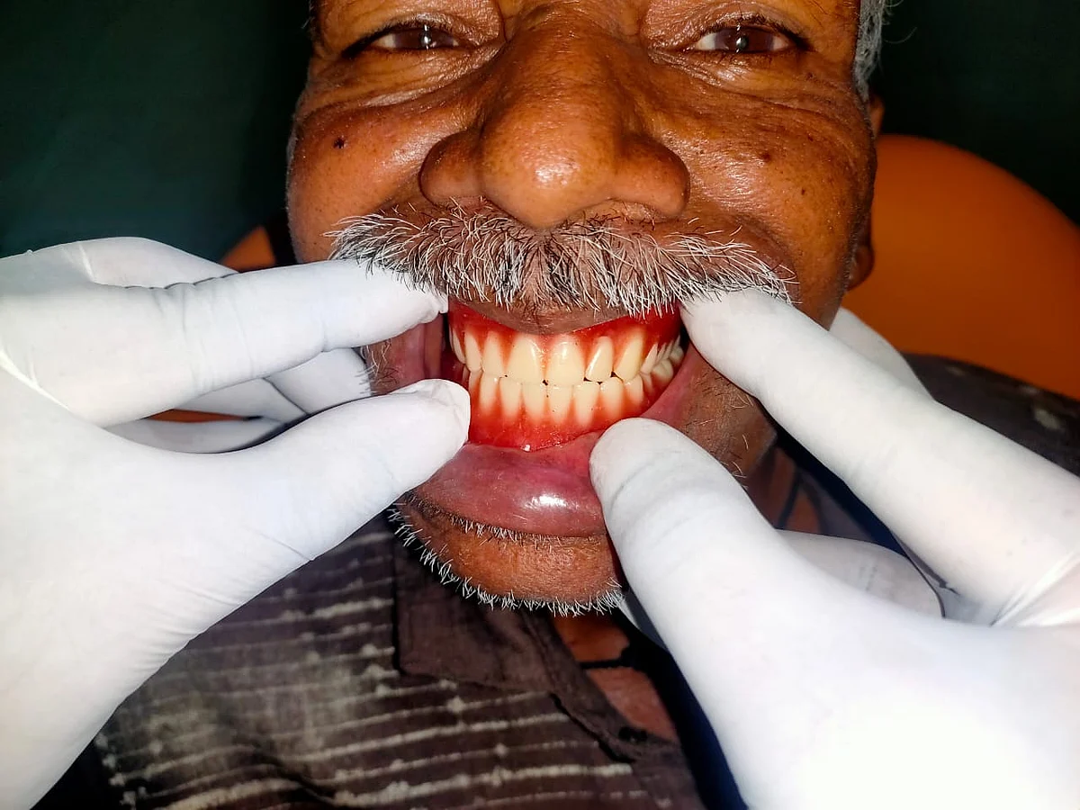 Baskaran showing off his new set of teeth.