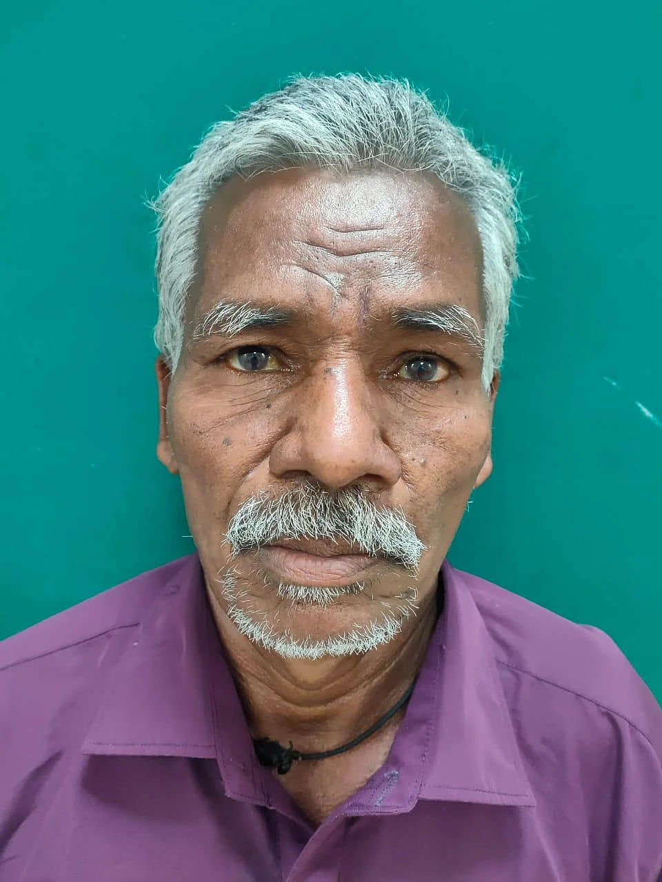 Baskaran has received a new set of teeth.