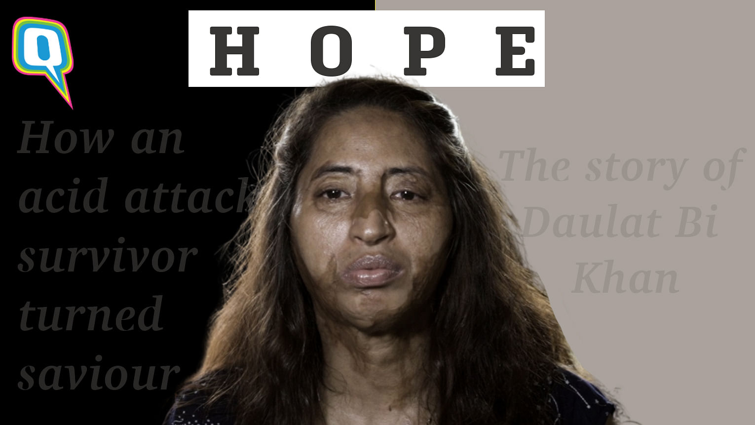 Helping acid attack survivors live better lives... one step at a time.
