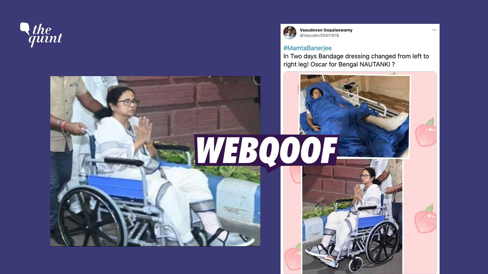 West Bengal Chief Minister Mamata Banerjee’s image in a wheelchair has been flipped to share the false claim that her injury shifted from her left leg to her right.