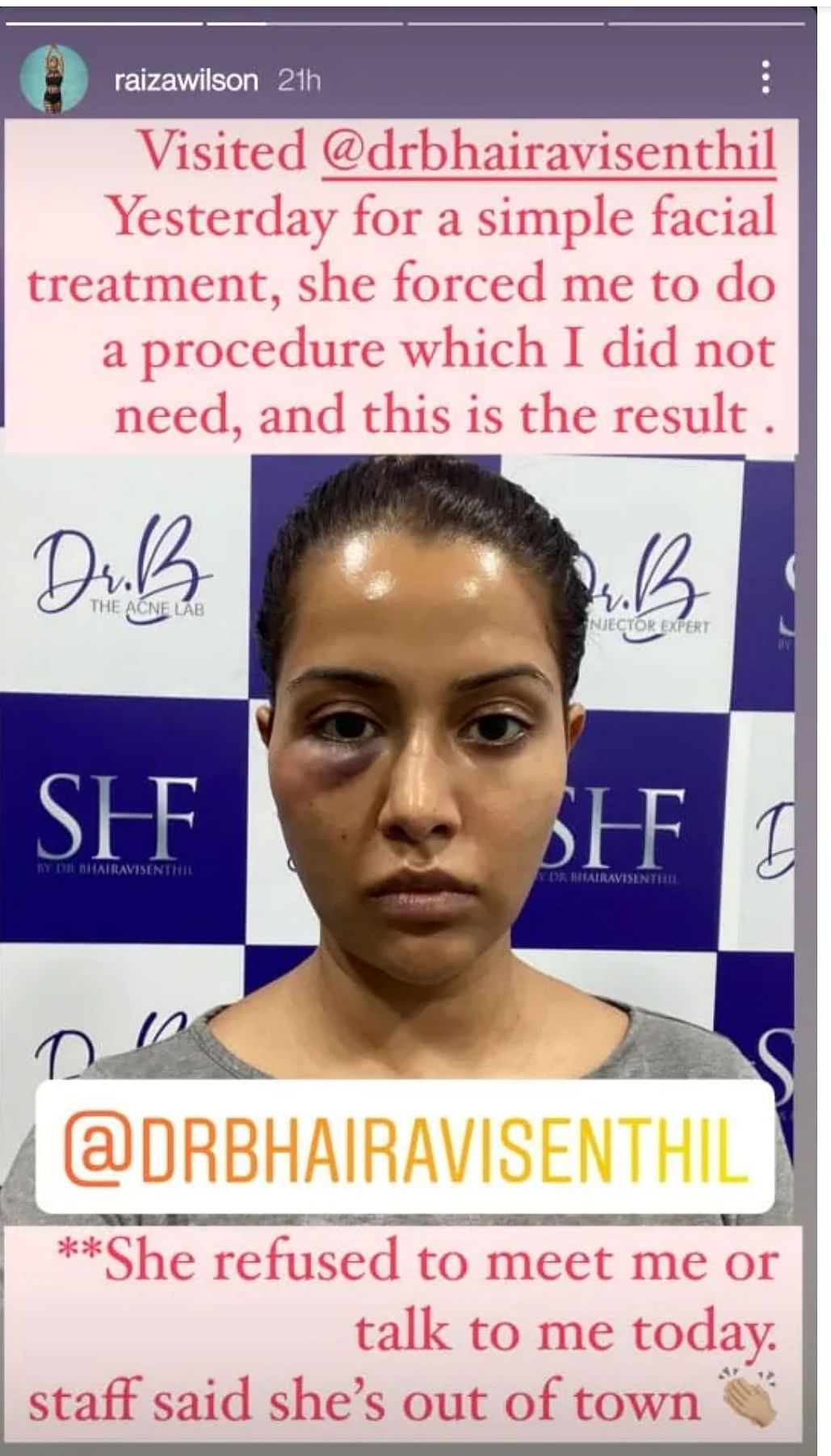 The actor shared a picture of the procedure gone wrong