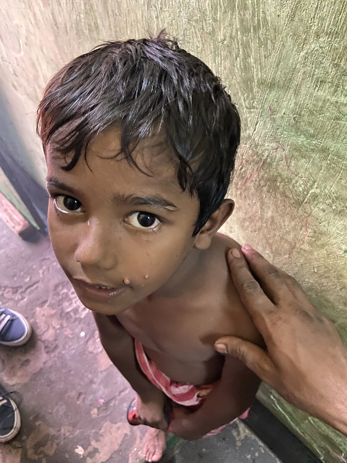 The scars on Memjit Ayyub’s youngest son