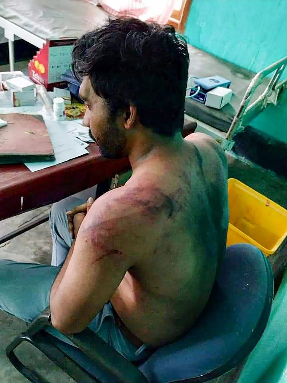 A picture of Dr Seuj Kumar Senapati, a medical officer of Udali COVID care centre, who was assaulted by miscreants, in Hojai district of Assam.