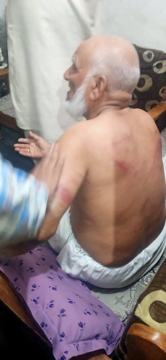 The men allegedly forced him to chant Jai Sri Ram, cut Saifi’s beard and assaulted him for 4 hours in Loni.