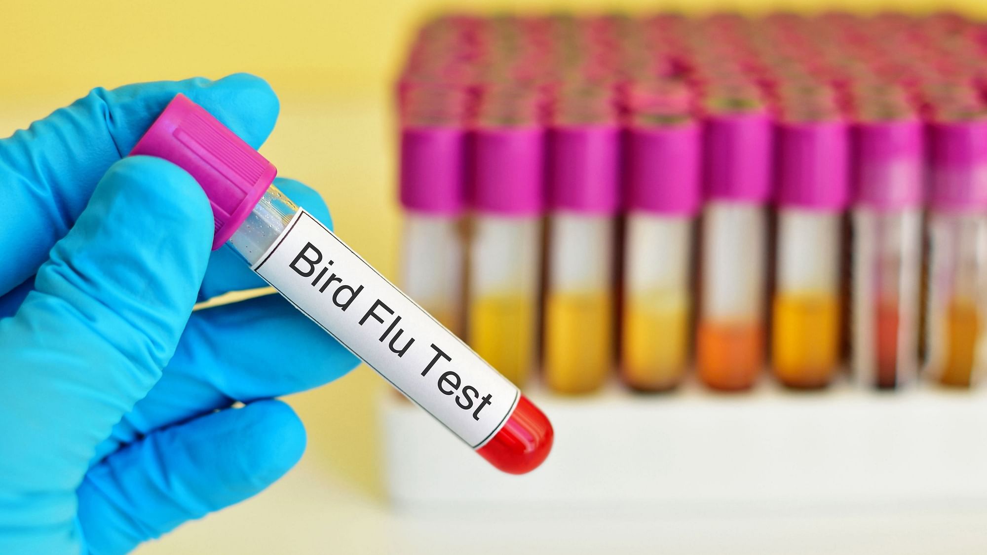 Bird flu: The H10N3 strain of bird flu has been detected in humans for the first time in China.