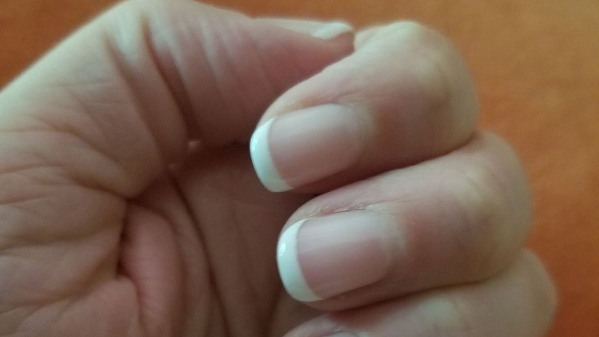 COVID Fingernails: These Changes May Show You’ve Had The Virus
