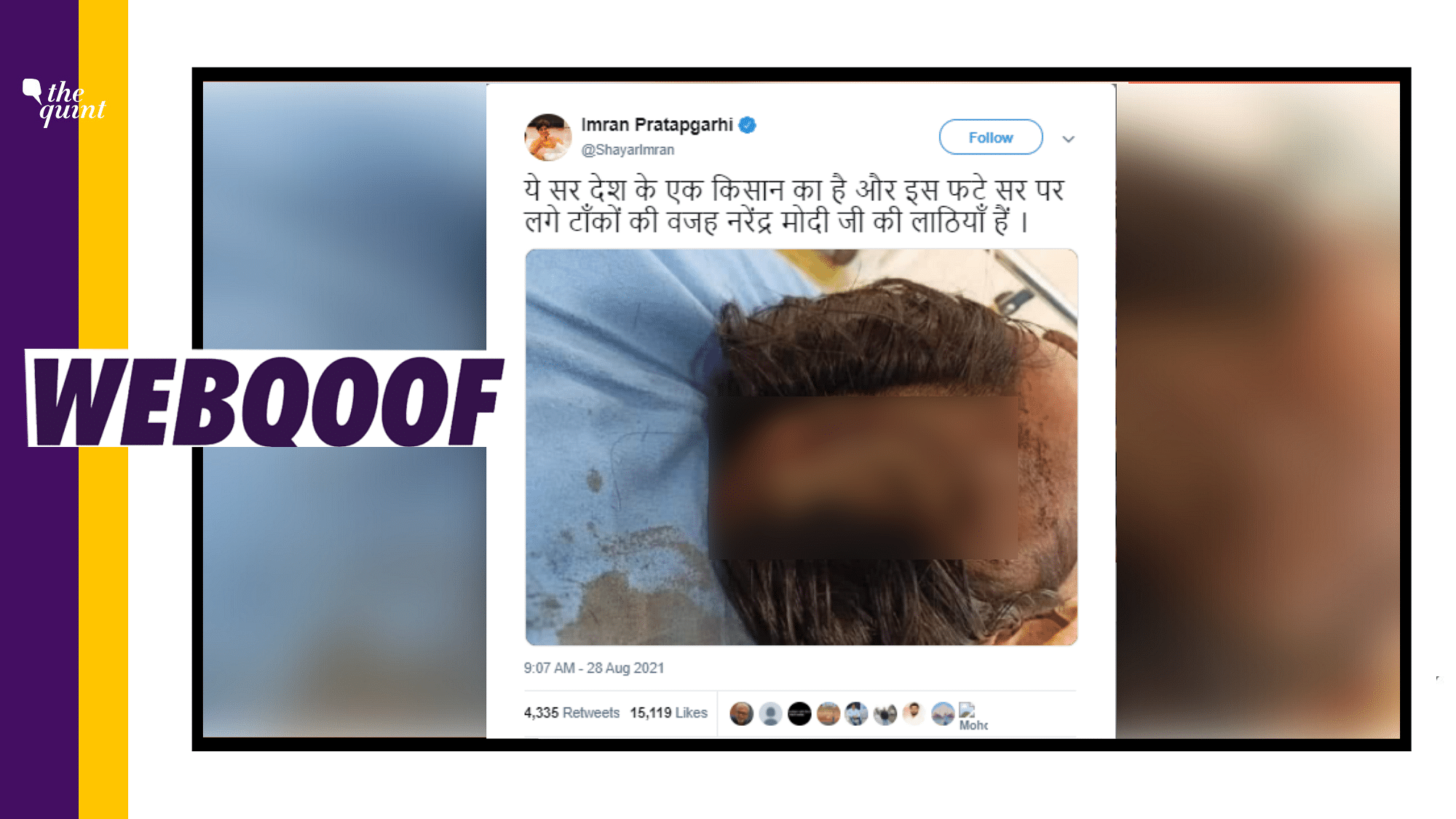 <div class="paragraphs"><p>The unrelated photo of a person injured in Gurugram was falsely shared as an 'injured farmer'.</p></div>