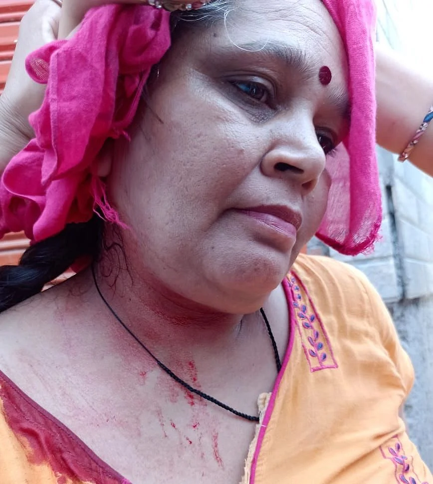 <div class="paragraphs"><p>This is Kamlesh who was injured on her head.</p></div>