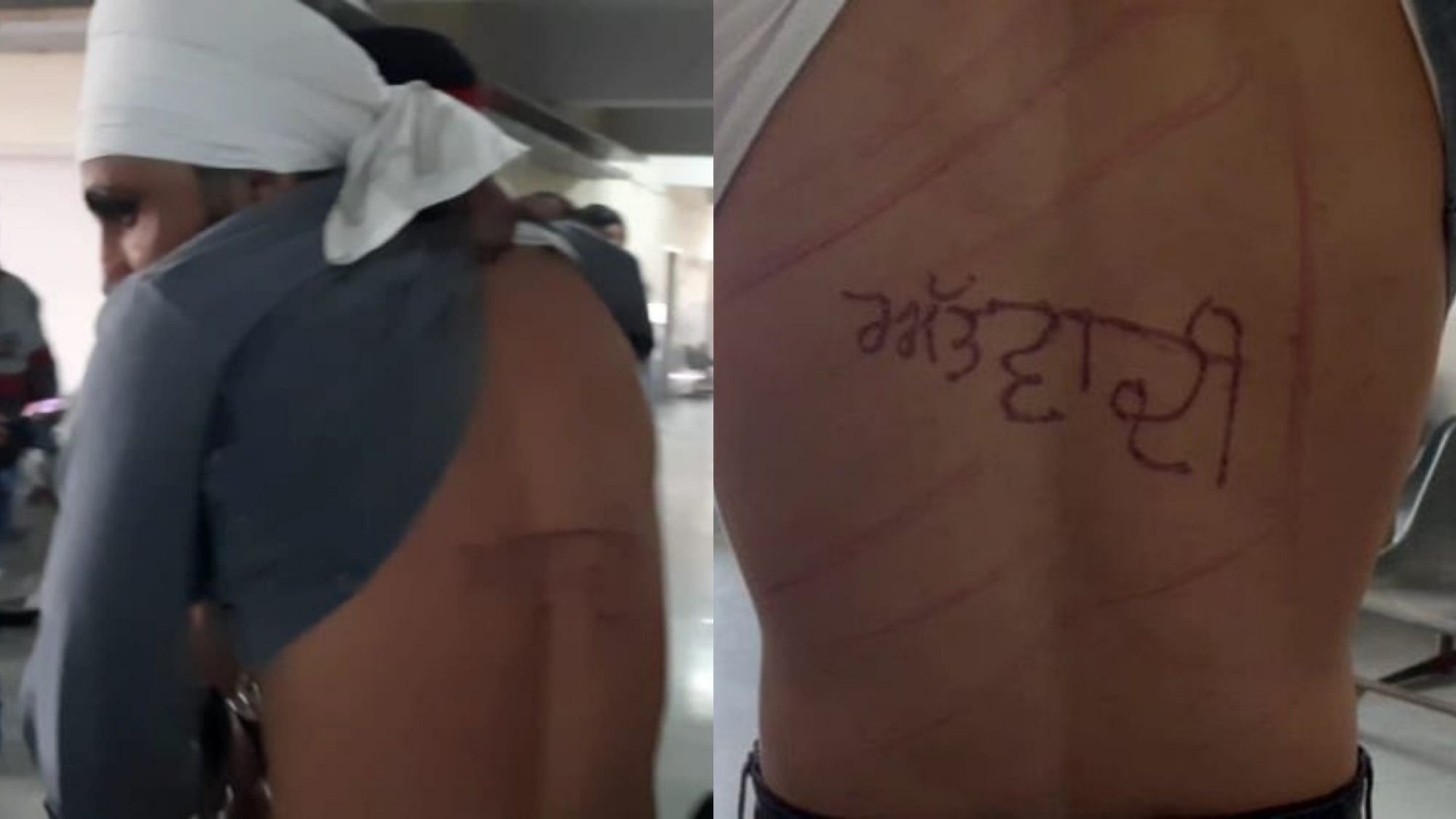<div class="paragraphs"><p>Karamjit Singh, a prisoner in Punjab's Barnala district, has accused the jail superintendent of branding the word '<em>aatwadi</em>' ('terrorist' in Punjabi) on his back.</p></div>