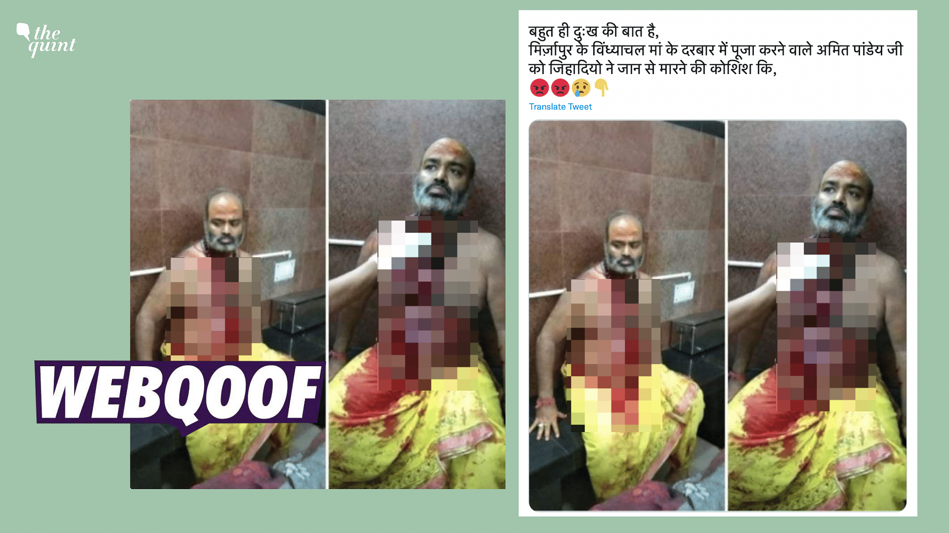 <div class="paragraphs"><p>The photos show a priest who was injured after an altercation with another priest from the same temple.</p></div>