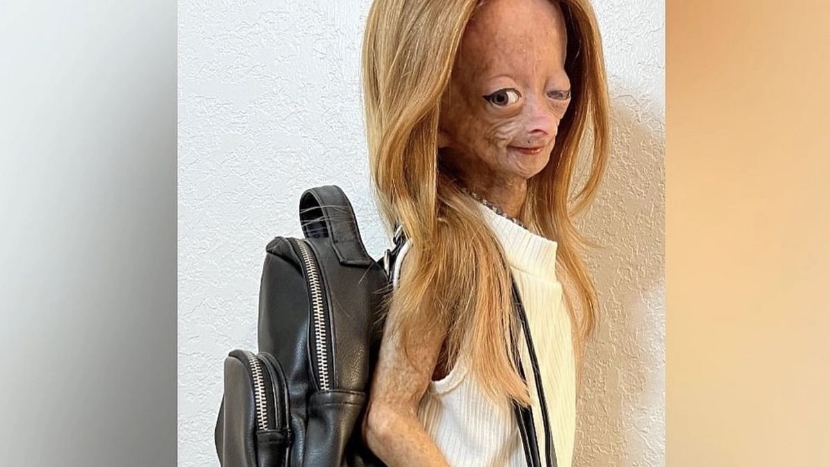 progeria adalia rose 2022