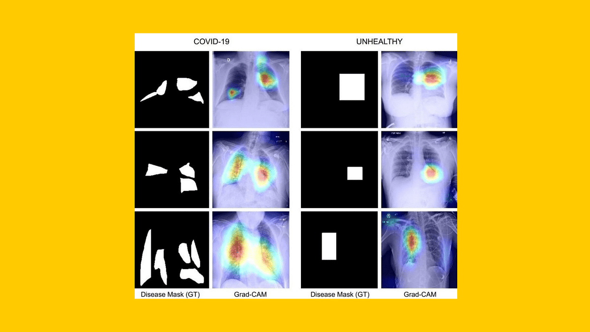 IIT Jodhpur Team Develops COVID-19 Diagnosis Technique Using Chest X-Ray: Report