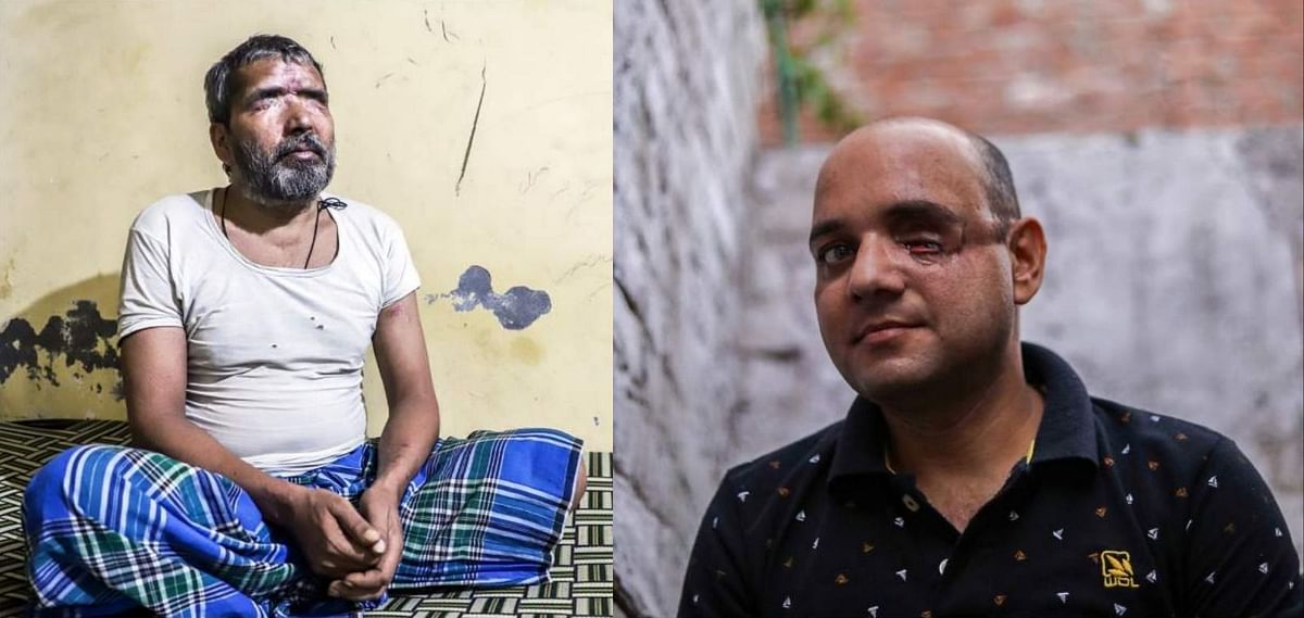 <div class="paragraphs"><p>Mohammad Wakeel (left) lost his vision after facing an acid attack by a Hindu mob and Mohammad Nasir Khan (right) lost his left eye to a gunshot</p></div>