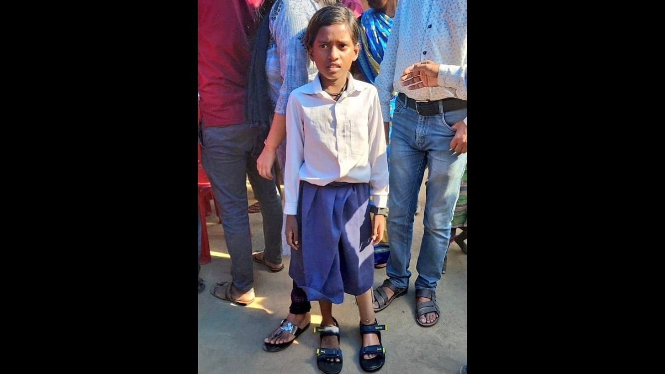 <div class="paragraphs"><p>10-year-old Seema seen wearing the prosthetic leg. </p></div>